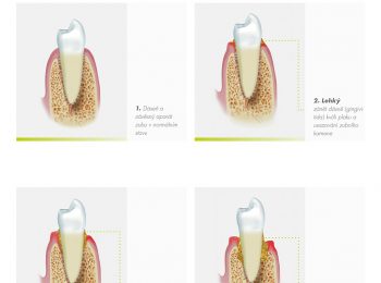 Info_Board_Regeneration.indd